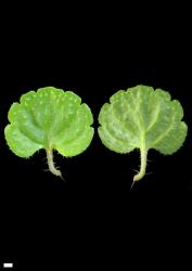 Veronica filiformis. Leaf surfaces, adaxial (left) and abaxial (right). Scale = 1 mm.
 Image: P.J. Garnock-Jones © P.J. Garnock-Jones CC-BY-NC 3.0 NZ
